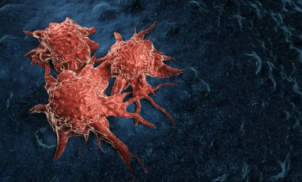 Más microplásticos en pacientes con cáncer de pulmón: el estudio eleva la presión sobre los controles